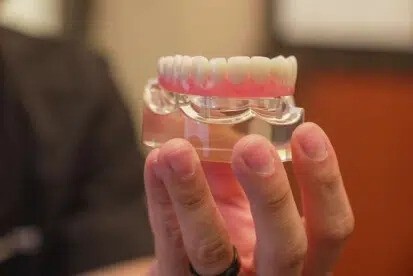 Dental implants team at Young Dental